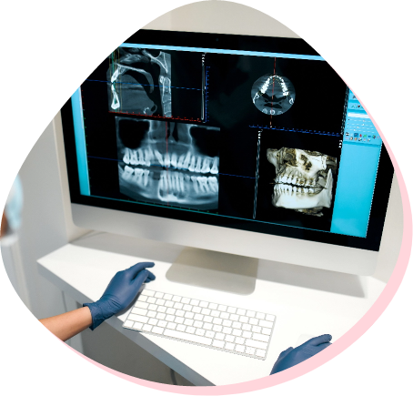 DIGITAL CARIES DETECTOR